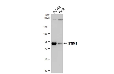 Anti-STIM1 antibody [HL4832] used in Western Blot (WB). GTX644895