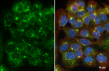 Anti-STIM1 antibody [HL4832] used in Immunocytochemistry/ Immunofluorescence (ICC/IF). GTX644895