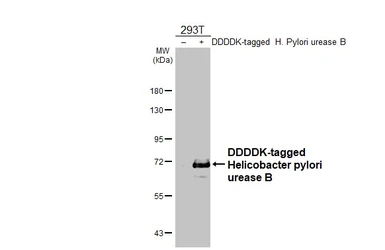 Anti-Helicobacter pylori urease B antibody [HL4834] used in Western Blot (WB). GTX644897