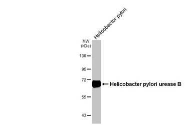 Anti-Helicobacter pylori urease B antibody [HL4834] used in Western Blot (WB). GTX644897