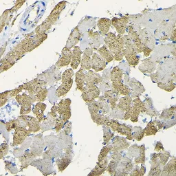 Anti-HSP22 antibody used in IHC (Paraffin sections) (IHC-P). GTX64490