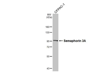 Anti-Semaphorin 3A antibody [HL4837] used in Western Blot (WB). GTX644900