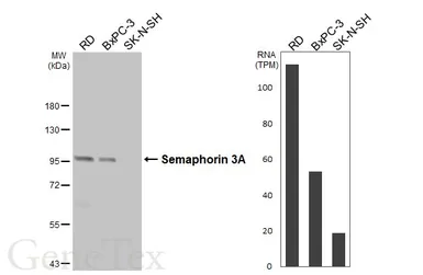 Anti-Semaphorin 3A antibody [HL4837] used in Western Blot (WB). GTX644900