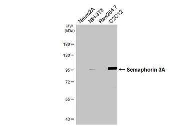 Anti-Semaphorin 3A antibody [HL4838] used in Western Blot (WB). GTX644901