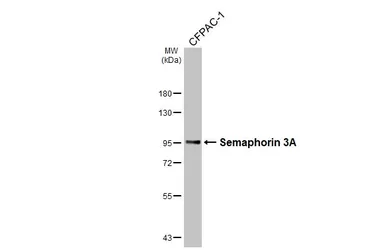 Anti-Semaphorin 3A antibody [HL4838] used in Western Blot (WB). GTX644901
