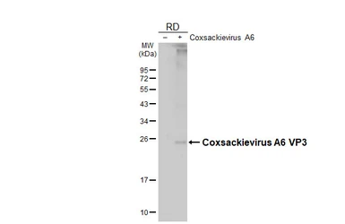 Anti-Coxsackievirus A6 VP3 antibody [HL4839] used in Western Blot (WB). GTX644902