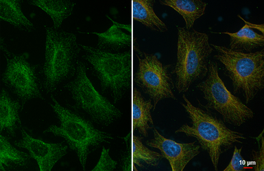 Anti-ALIX antibody [HL4841] used in Immunocytochemistry/ Immunofluorescence (ICC/IF). GTX644904