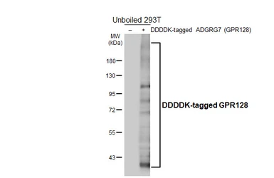 Anti-GPR128 antibody [HL4855] used in Western Blot (WB). GTX644918