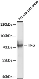 Anti-HRG antibody used in Western Blot (WB). GTX64492