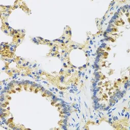 Anti-HRG antibody used in IHC (Paraffin sections) (IHC-P). GTX64492