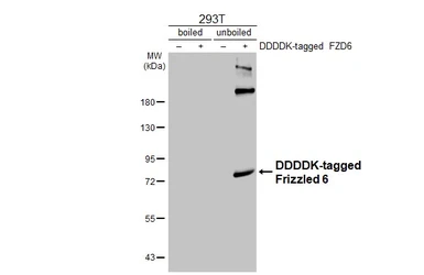 Anti-Frizzled 6 antibody [HL4857] used in Western Blot (WB). GTX644920