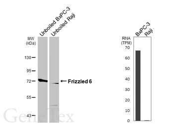 Anti-Frizzled 6 antibody [HL4857] used in Western Blot (WB). GTX644920