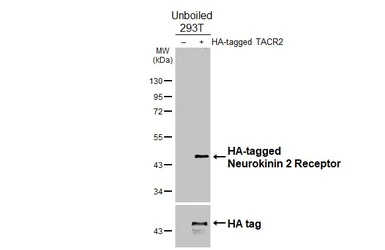 Anti-Neurokinin 2 Receptor antibody [HL4859] used in Western Blot (WB). GTX644922