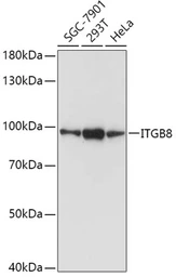 Anti-Integrin beta 8 antibody used in Western Blot (WB). GTX64493
