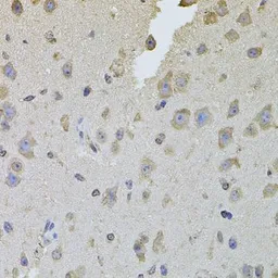 Anti-Integrin beta 8 antibody used in IHC (Paraffin sections) (IHC-P). GTX64493