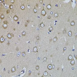 Anti-Integrin beta 8 antibody used in IHC (Paraffin sections) (IHC-P). GTX64493