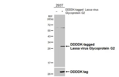 Anti-Lassa virus Glycoprotein G2 antibody [HL4882] used in Western Blot (WB). GTX644947