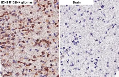 Anti-IDH1 (R132H Mutant) antibody [HL4884] used in IHC (Paraffin sections) (IHC-P). GTX644949