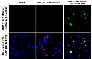 Anti-IDH1 (R132H Mutant) antibody [HL4884] used in IHC-P (cell pellet) (IHC-P (cell pellet)). GTX644949