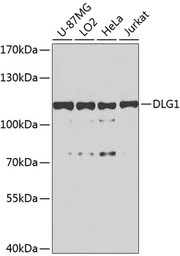 Anti-SAP97 antibody used in Western Blot (WB). GTX64496