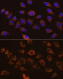 Anti-SAP97 antibody used in Immunocytochemistry/ Immunofluorescence (ICC/IF). GTX64496