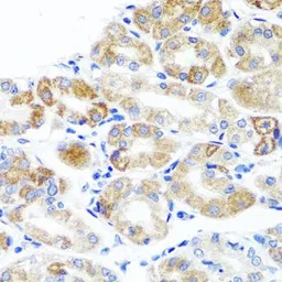 Anti-SAP97 antibody used in IHC (Paraffin sections) (IHC-P). GTX64496