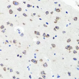 Anti-SAP97 antibody used in IHC (Paraffin sections) (IHC-P). GTX64496