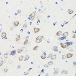 Anti-SAP97 antibody used in IHC (Paraffin sections) (IHC-P). GTX64496