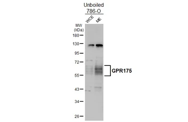 Anti-GPR175 antibody [HL4903] used in Western Blot (WB). GTX644968