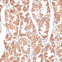 Anti-KIF4A antibody used in IHC (Paraffin sections) (IHC-P). GTX64498