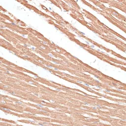 Anti-KIF4A antibody used in IHC (Paraffin sections) (IHC-P). GTX64498