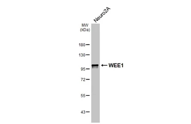 Anti-WEE1 antibody [HL4911] used in Western Blot (WB). GTX644984