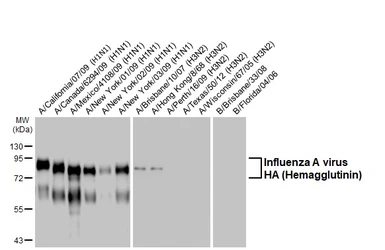 Anti-Influenza A virus H1N1 HA (Hemagglutinin) antibody [HL4914] used in Western Blot (WB). GTX644987