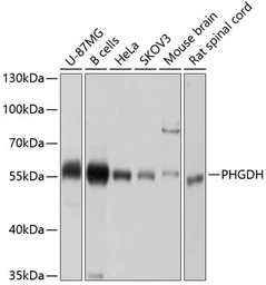 Anti-PHGDH antibody used in Western Blot (WB). GTX64499