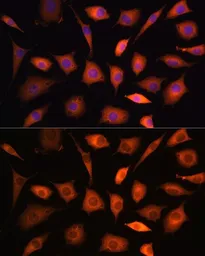 Anti-PHGDH antibody used in Immunocytochemistry/ Immunofluorescence (ICC/IF). GTX64499