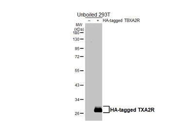 Anti-TXA2R antibody [HL4935] used in Western Blot (WB). GTX645008