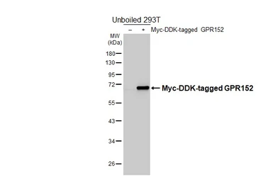Anti-GPR152 antibody [HL4936] used in Western Blot (WB). GTX645009