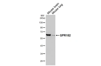 Anti-GPR152 antibody [HL4936] used in Western Blot (WB). GTX645009