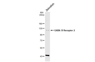 Anti-GABA B Receptor 2 antibody [HL4937] used in Western Blot (WB). GTX645010