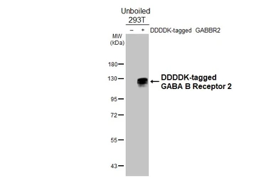 Anti-GABA B Receptor 2 antibody [HL4937] used in Western Blot (WB). GTX645010