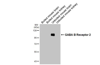 Anti-GABA B Receptor 2 antibody [HL4937] used in Western Blot (WB). GTX645010