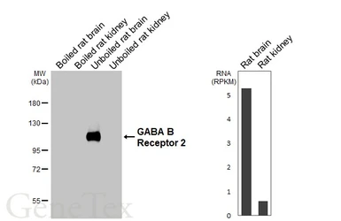 Anti-GABA B Receptor 2 antibody [HL4937] used in Western Blot (WB). GTX645010