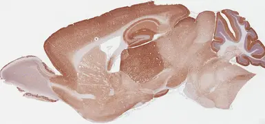 Anti-GABA B Receptor 2 antibody [HL4937] used in IHC (Paraffin sections) (IHC-P). GTX645010