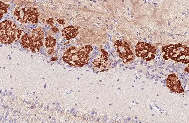 Anti-GABA B Receptor 2 antibody [HL4937] used in IHC (Paraffin sections) (IHC-P). GTX645010