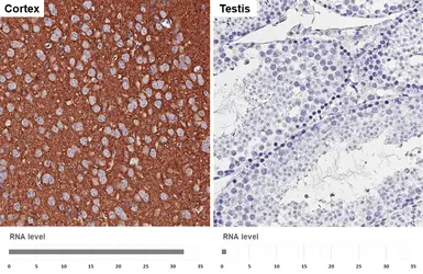 Anti-GABA B Receptor 2 antibody [HL4937] used in IHC (Paraffin sections) (IHC-P). GTX645010