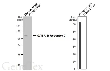Anti-GABA B Receptor 2 antibody [HL4937] used in Western Blot (WB). GTX645010