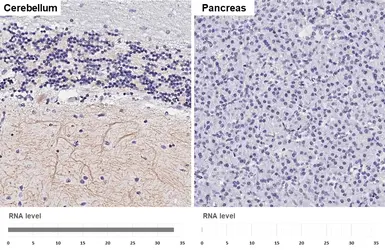 Anti-GABA B Receptor 2 antibody [HL4937] used in IHC (Paraffin sections) (IHC-P). GTX645010