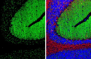 Anti-GABA B Receptor 2 antibody [HL4937] used in IHC (Paraffin sections) (IHC-P). GTX645010
