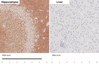 Anti-GABA B Receptor 2 antibody [HL4937] used in IHC (Paraffin sections) (IHC-P). GTX645010