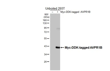 Anti-AVPR1B antibody [HL4945] used in Western Blot (WB). GTX645018